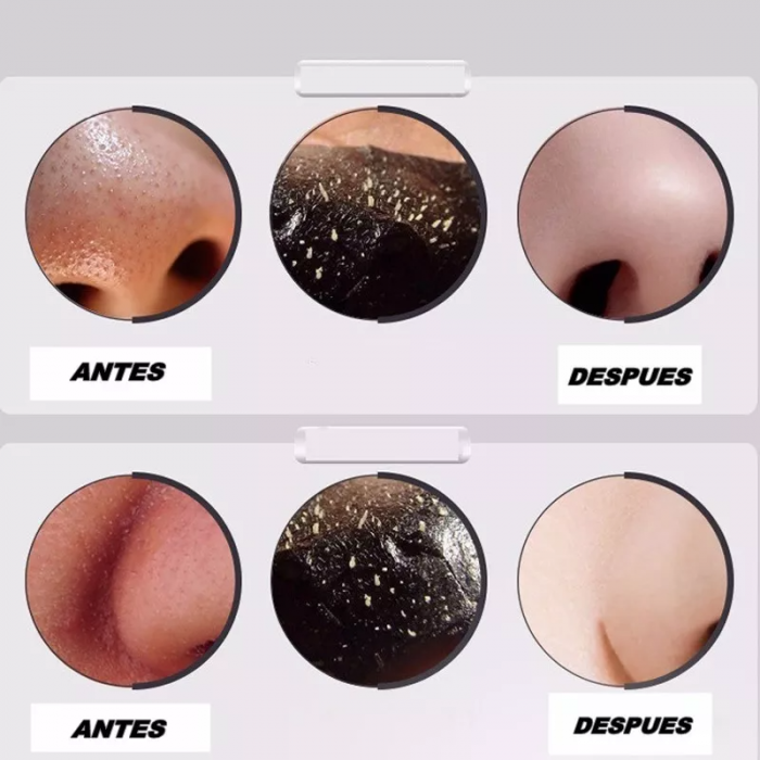 COMBO 2 PARES PEZONERAS DE SILICONA ADHESIVAS COLOR PIEL +Mascara Limpiador Facial Antiacne Puntos Negros x 10 Unidades REGALO